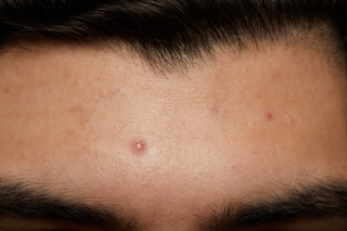 HD Face Skin Jonathan Campos face forehead hair skin pores…